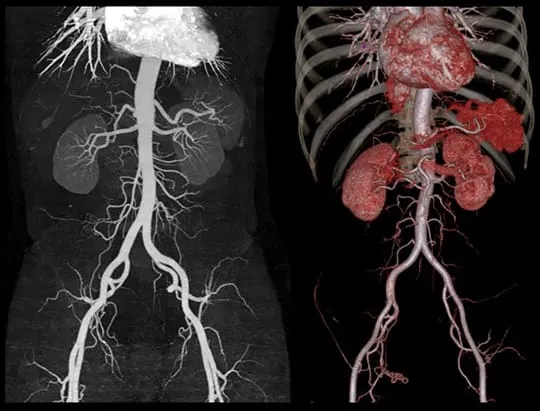 Structuri vasculare fine